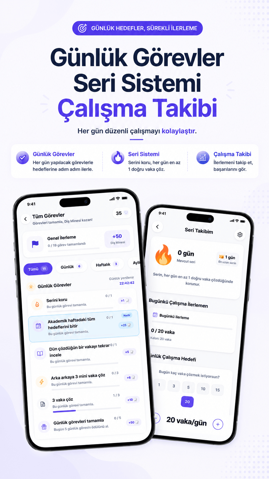 Günlük Görevler ve Seriler özelliği ekran görüntüsü